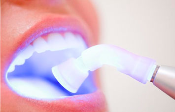 Биоптрон в стоматологии